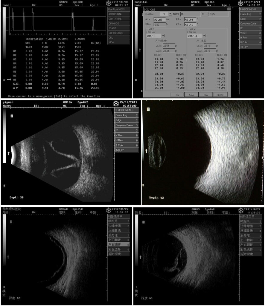 Ophthalmic A and B Scan » Science Power Bangladesh SPB