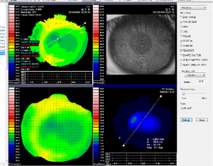 Corneal Topography Machine - Image 4