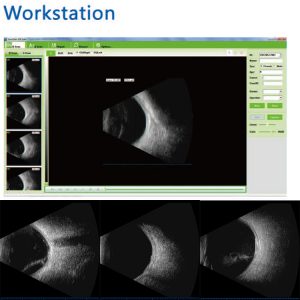 Ultrasound Bio Microscope - Image 4