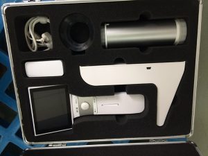Portable Fundus Camera - Image 4