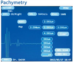 A Scan and Pachymetry SP 1000AP - Image 4