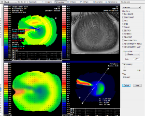 Corneal Topography Machine - Image 5