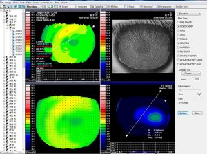 Corneal Topography Machine - Image 6