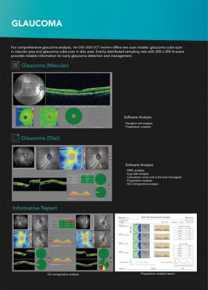 OCT Optical Coherence Tomography OSE 3000 - Image 6