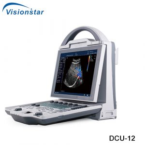 Color Doppler Ultrasound Machine DCU 12