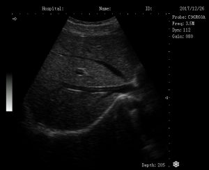 Trolley Black & White Ultrasound Machine HY 370 - Image 3