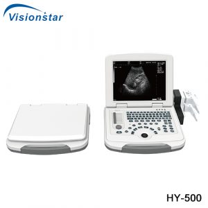 Laptop Portable Black & White Ultrasound Scanner