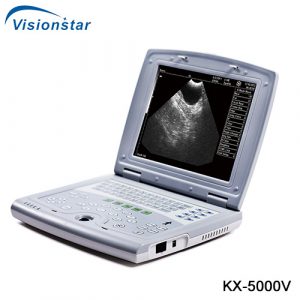 Veterinary B Mode Portable Ultrasound Machine KX 5000V