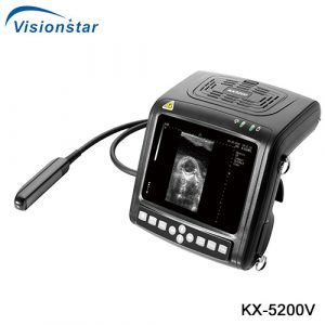B Mode Veterinary Ultrasound Scanner KX 5200V
