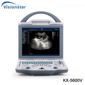 B Mode Veterinary Ultrasound Scanner KX 5600V