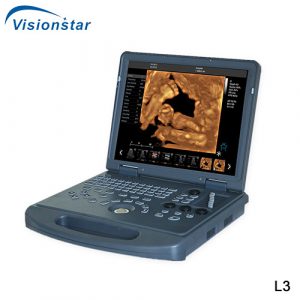 Laptop Color Doppler 4D Portable Ultrasound Machine