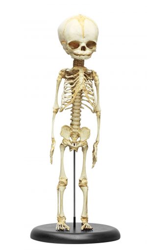 Fetus Skeleton 30 week