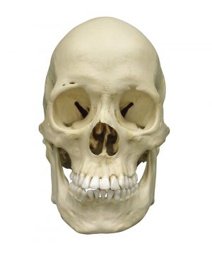 Scaphocephalic skull - Image 2