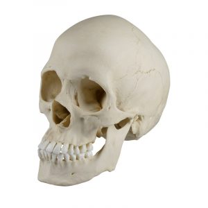 Scaphocephalic skull