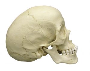 Scaphocephalic skull - Image 4