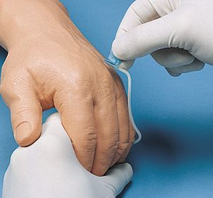 I v Injection Hand - Image 2