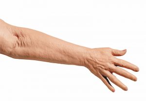 Geriatric IV Training Arm - Image 2