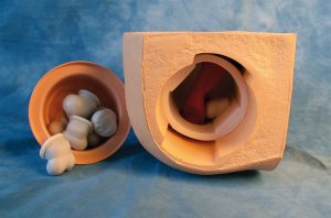 Clinical Prostate Rectal Examination