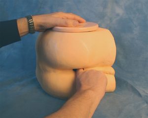 Clinical Prostate Rectal Examination