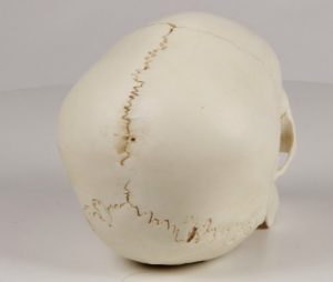 Child Skull 4 year Old - Image 3
