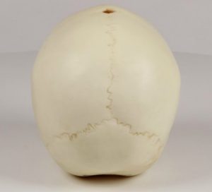 Child Skull 14 Months Old - Image 3
