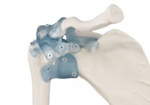 Elbow Joint With Ligaments With Stand - Image 3