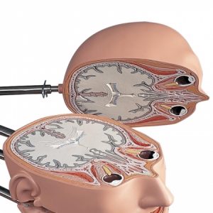 MRI Torso 15 Transverse Sections - Image 7