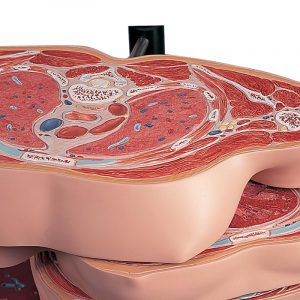 MRI Torso 15 Transverse Sections - Image 2