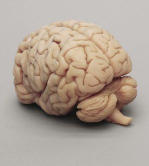 Human Brain Multiple Frontal Sections - Image 2