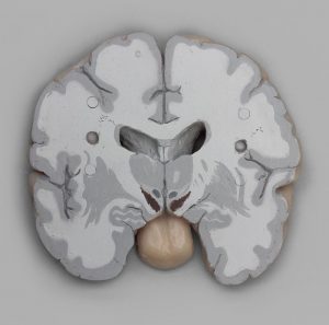 Human Brain Multiple Frontal Sections - Image 3