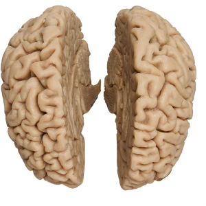Human Brain Actual Cast