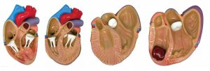 Heart Diseases Model - Image 2