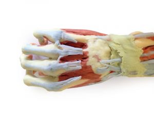 Deep Upper Limb And Hand AM01241 - Image 4