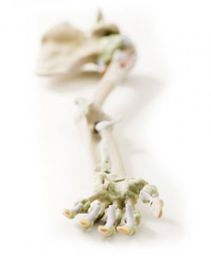 Upper Limb Ligaments - Image 5