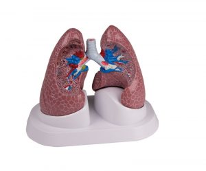 Lung Set with Pathologies - Image 3