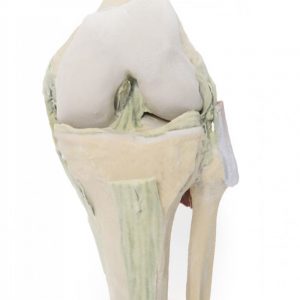 Flexed knee Joint