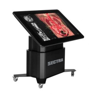 Anatomical Table Sectra