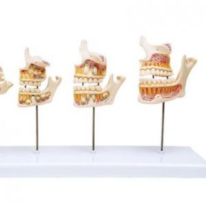 Dentition Development