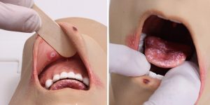 Advanced Oral Health Simulator With Pathologies - Image 3
