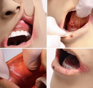 Advanced Oral Health Simulator With Pathologies - Image 4