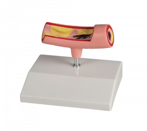 Artery Model