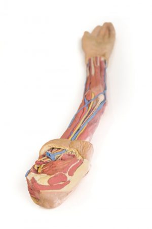 Model of Upper Limb - Image 4