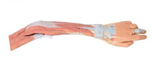 Upper Limb Elbow Forearm and Hand - Image 2