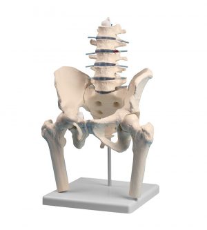 Lumbar Spine with Pelvis and Femoral Stumps
