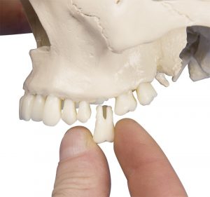 Dental Skull 4 Part - Image 3