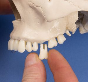 Dental Skull 4 Part - Image 6