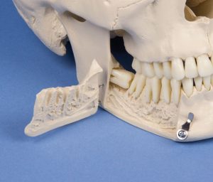 Dental Skull 4 Part - Image 7