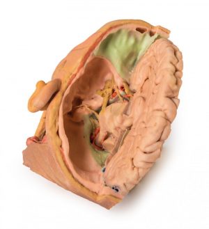 Head and Neck - Image 3