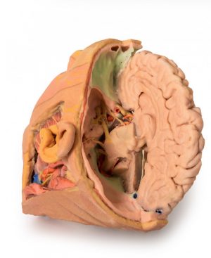 Model of Head and Neck