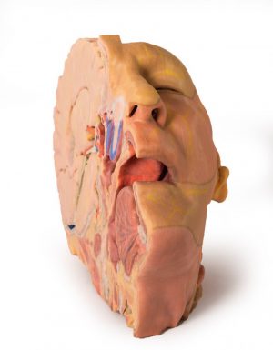 Head and Neck - Image 4